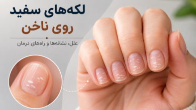 ناخن