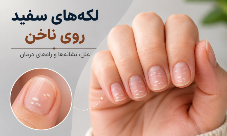 ناخن