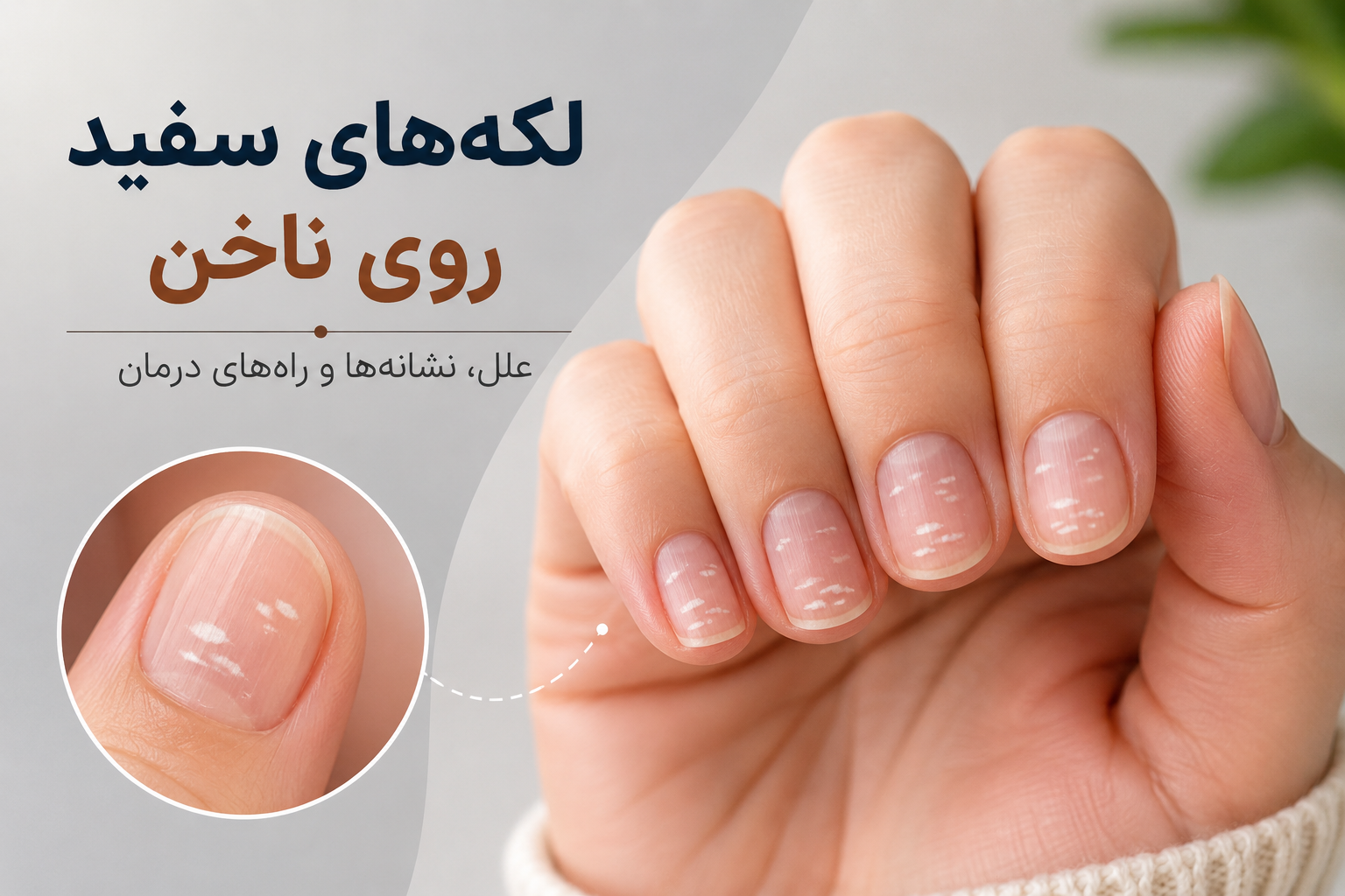 ناخن